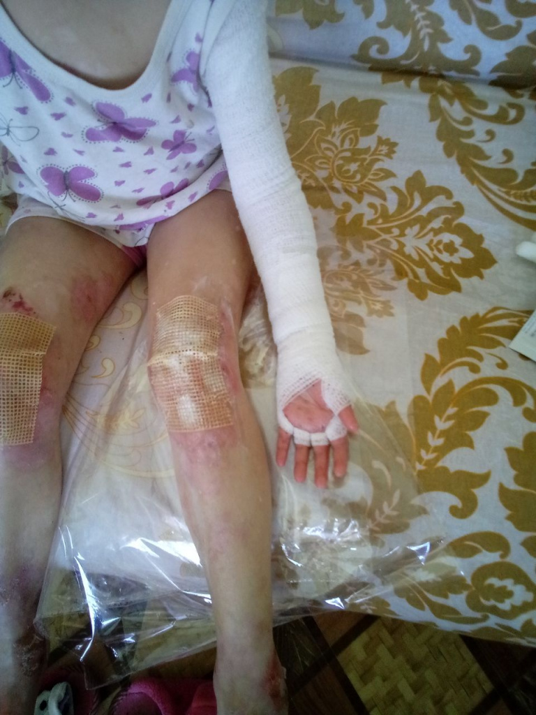 Ravshanova Dinora received antiseptics and ointments. (Kushkupir district) .jpg